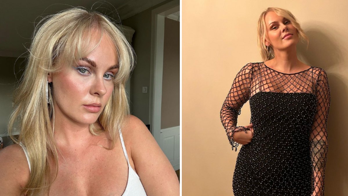 Sanna Guidetti om skönhetsoperationen: Inget ansvar