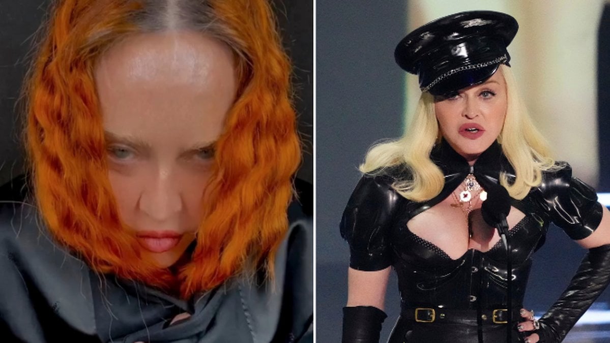 Madonna inlagd på sjukhus – skjuter fram turné
