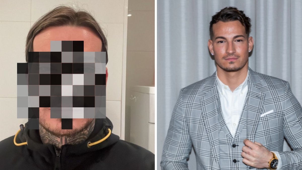 Otäcka bilderna på paradise hotel-profilen – efter skönhetsoperationen