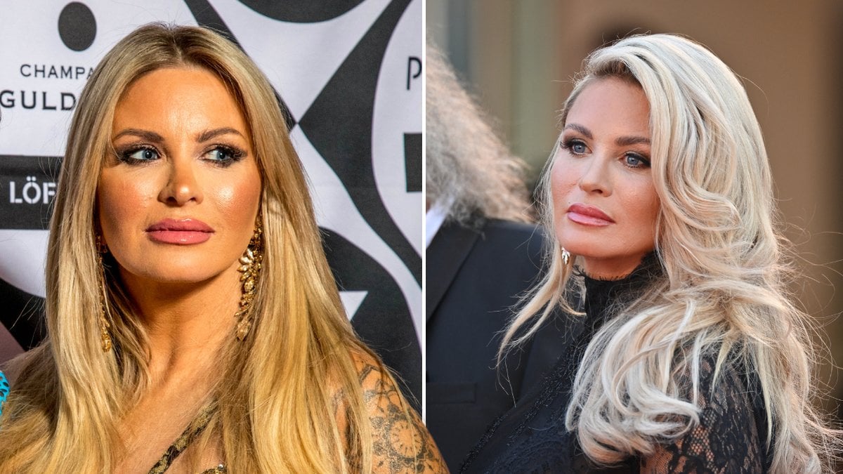 Carolina Gynning berättar om skönhetsingreppen: Som ett vanligt däckbyte