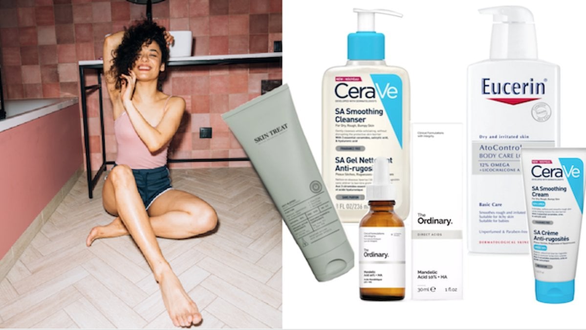 Keratosis Pilaris