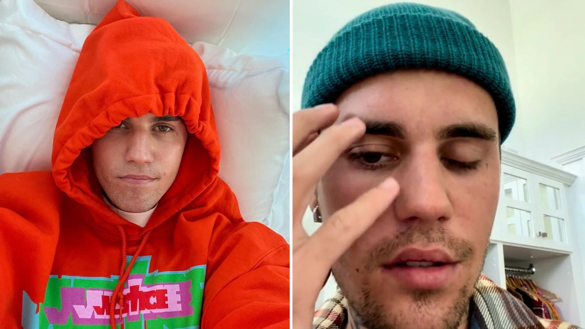 Justin Bieber avbryter turné – ställer in konsert i Sverige