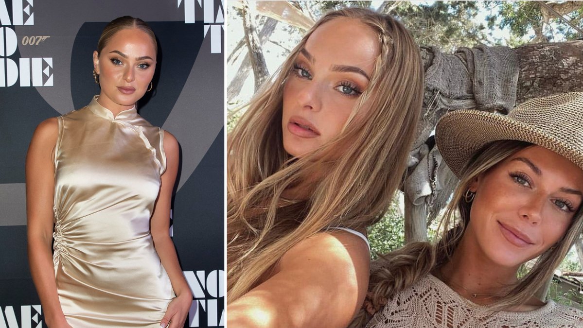 Alice Stenlöf berättar om botox-injektionen: Kunde inte äta mat