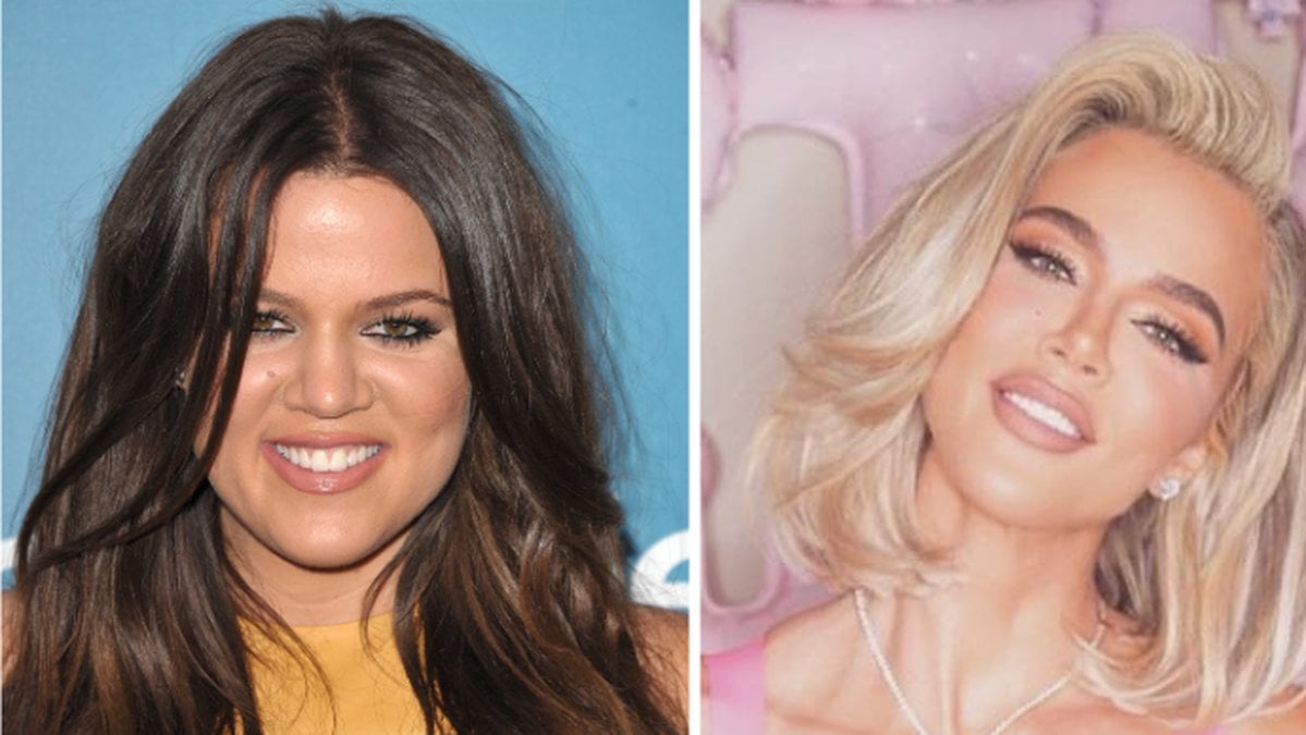 Följarna förundrade över Khloe Kardashians utseendeförändring: Vad har du gjort?