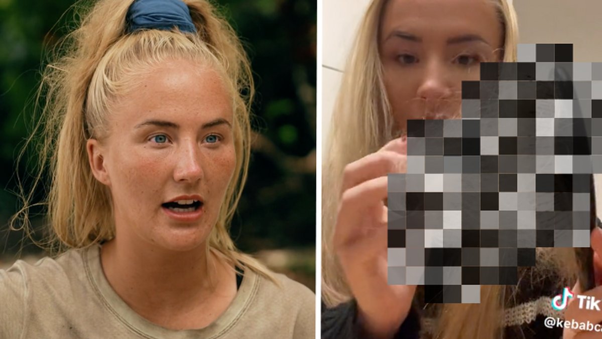 Caroline Persosn visar upp mängden hår hon tappade efter sin medverkan i Robinson 2023. 