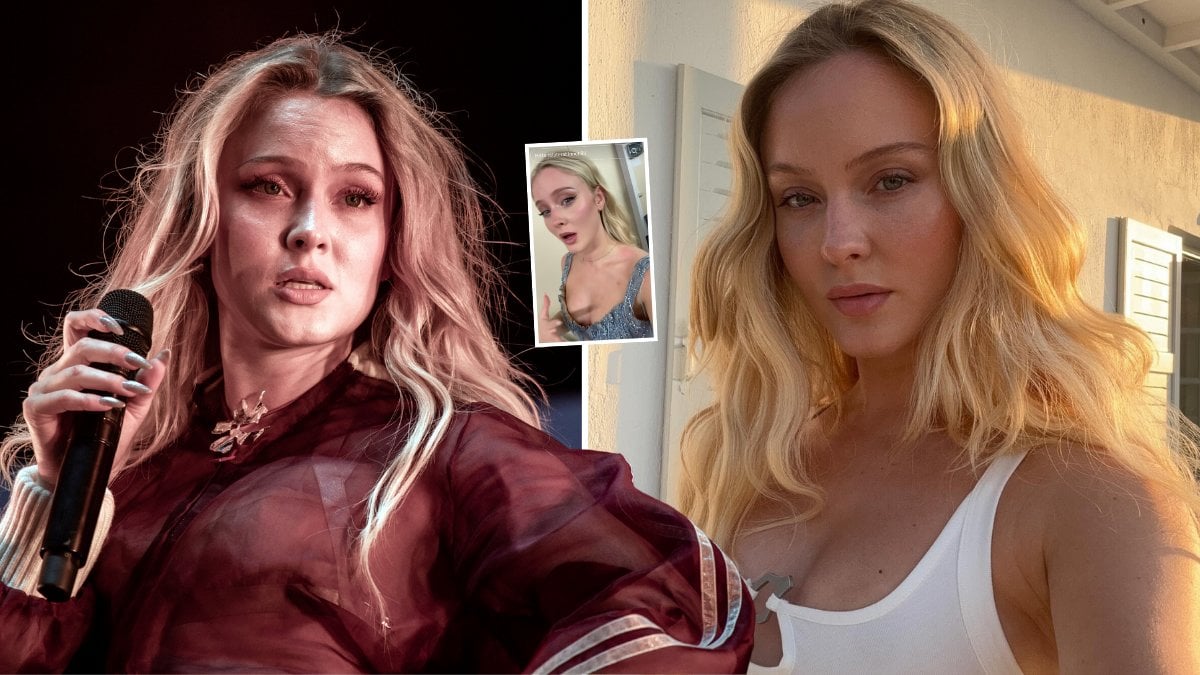 Zara Larsson fick utslag på kroppen