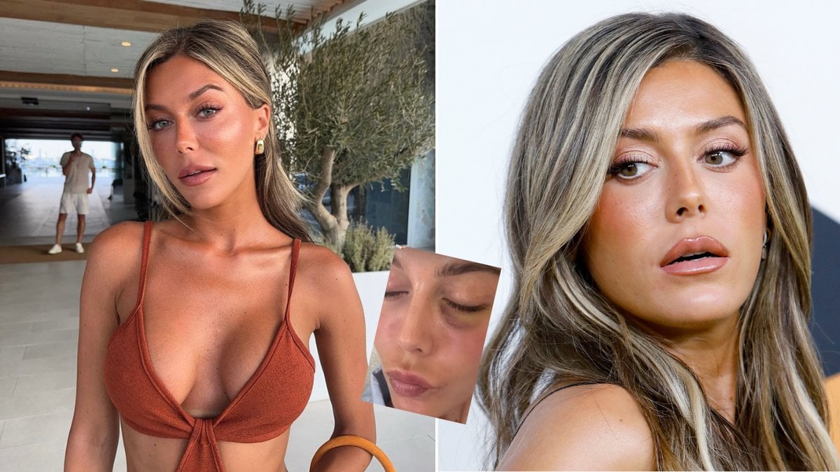 Bianca Ingrosso visar upp blåtiran: Inte blivit...