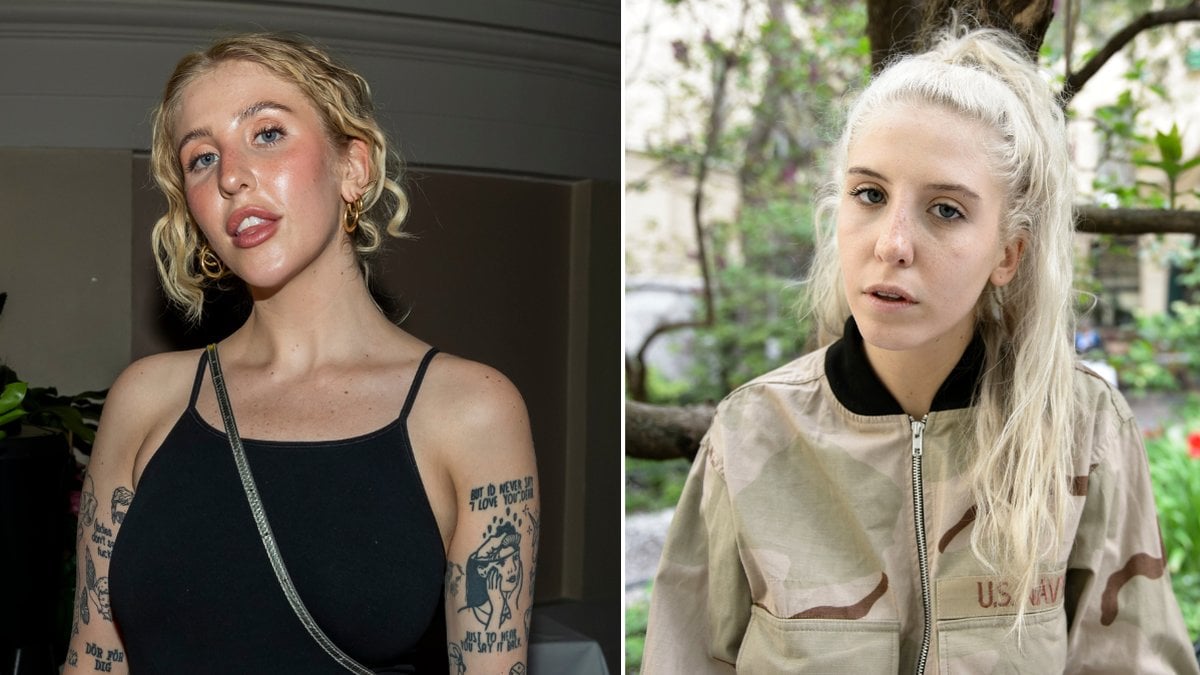 Peg Parneviks ord om skönhetsingreppen: Bara mänsklig